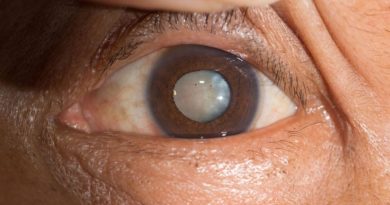 Cataracts can be dissolved by an eye drop that scientists have made