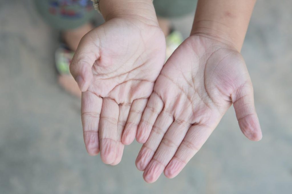 Wrinkly fingers